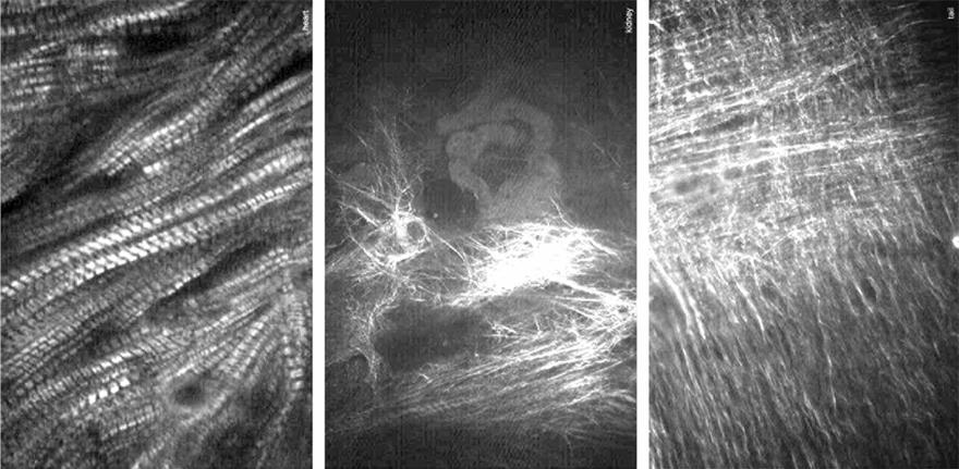 SHG images of collagen