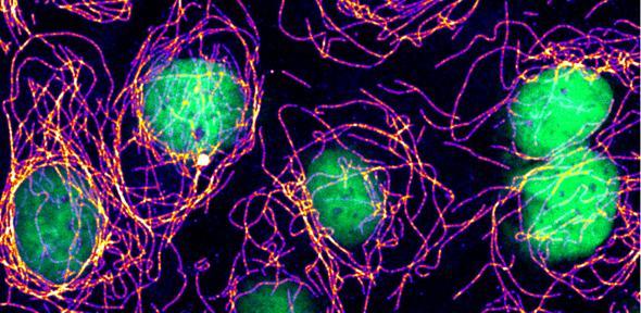 Using microscopy to systematically catalogue gene functions
