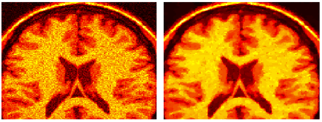 Sparse reconstruction for magnetic resonance imaging