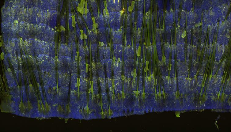 skin cells - MP fluorescence and second harmonic (SHG) non-linear imaging techniques
